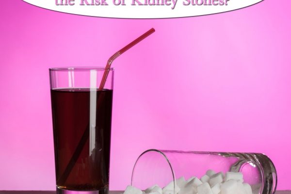 Kidney Stones